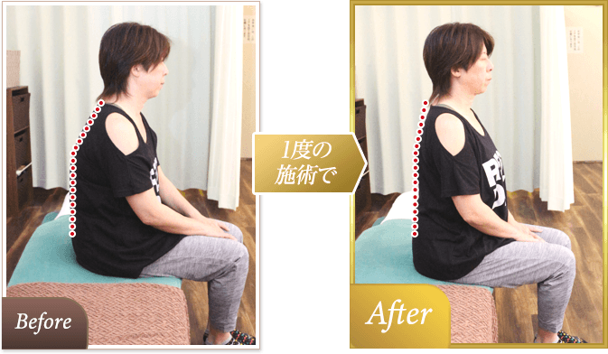 全く上がらなかった肩がまっすぐ上がるように!