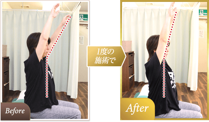 施術後キレイな姿勢になり痛みも改善